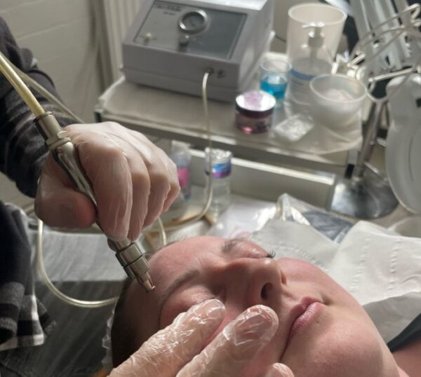 Microdermabrasion machine being used on a client