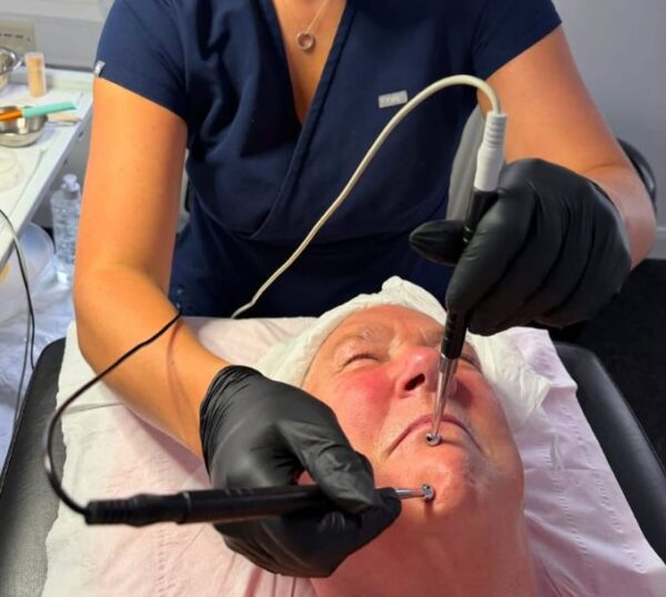 Therapist giving an electrical facial with a probe