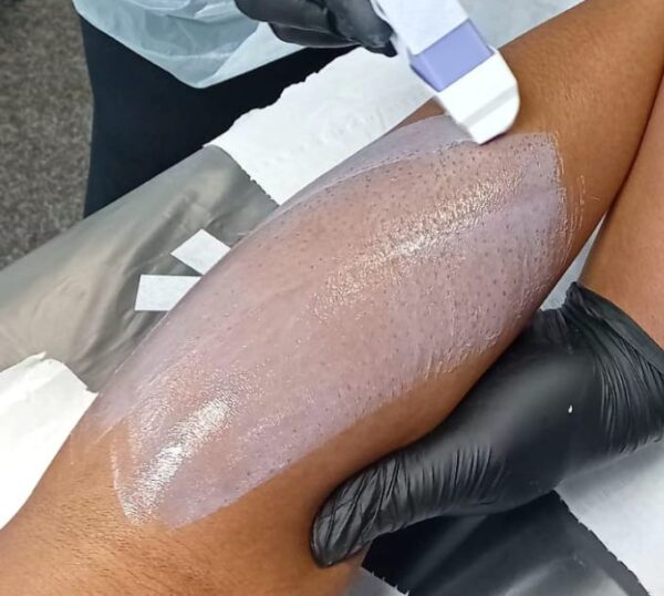 Warm wax being applied to a leg