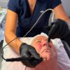 Therapist giving an electrical facial with a probe
