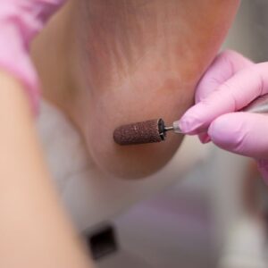 Pedicure using an electric file on the heel