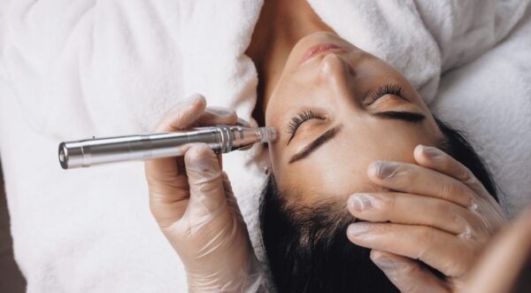 Client receiving a microneedling facial treatment